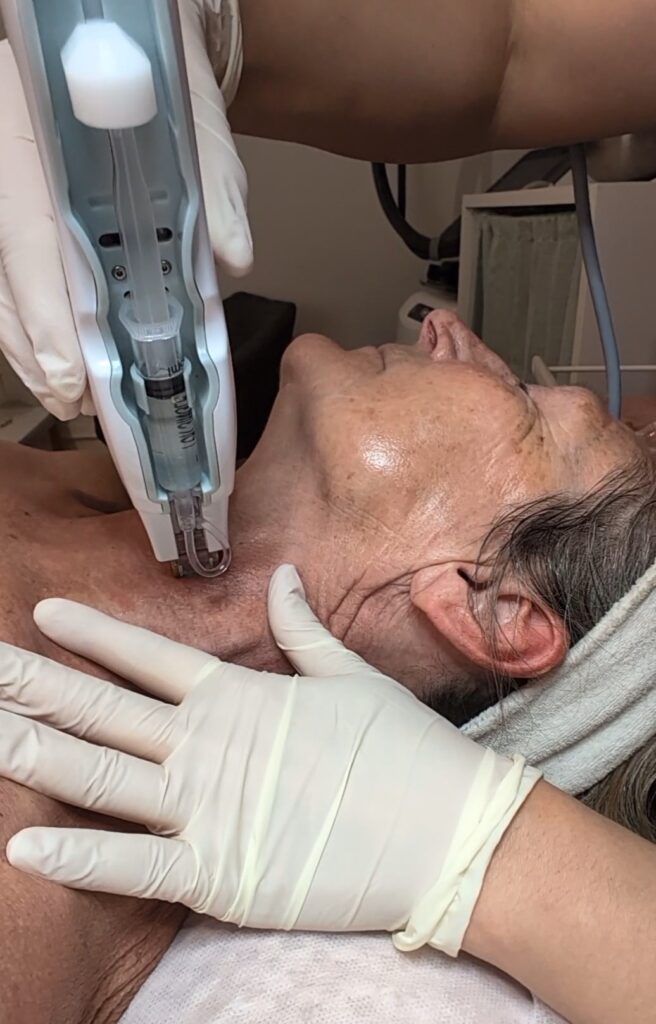 mesoskin ecladerm institut Genève soin visage