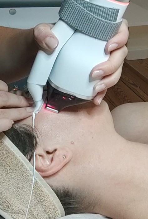 laser renuva geneve ecladerm institut
